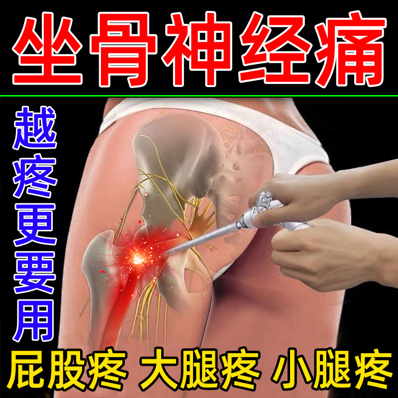 Sciatica paste cream lumbar spine thigh calf sore numbness pain leg pain hip rise difficulty walking big black cream