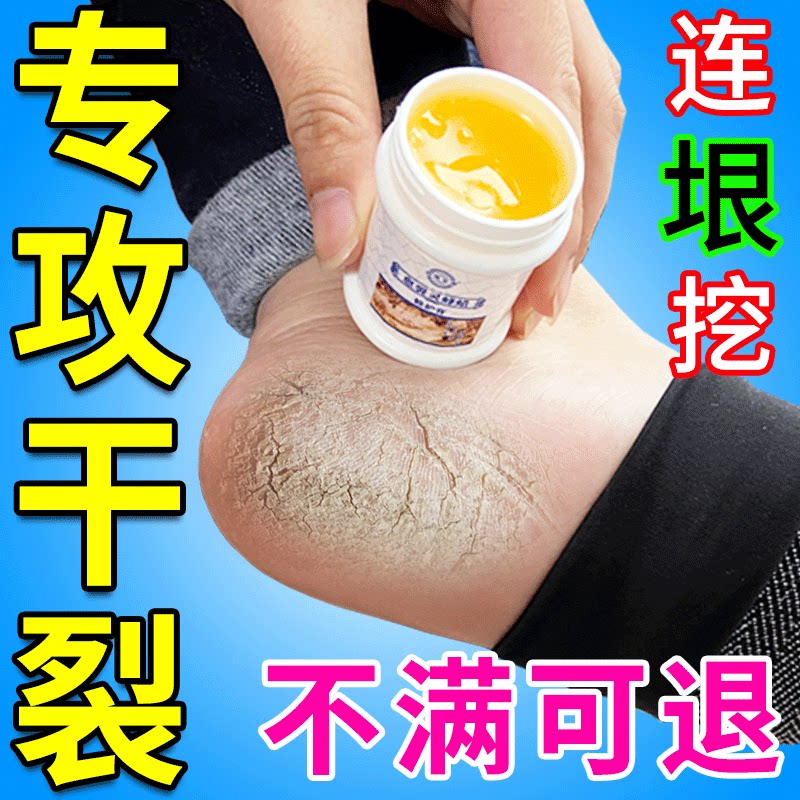 Cracked hands and feet repair hand cream heel cracking nemesis hand rough chapped peeling crack healing anti-crack cream - Taobao