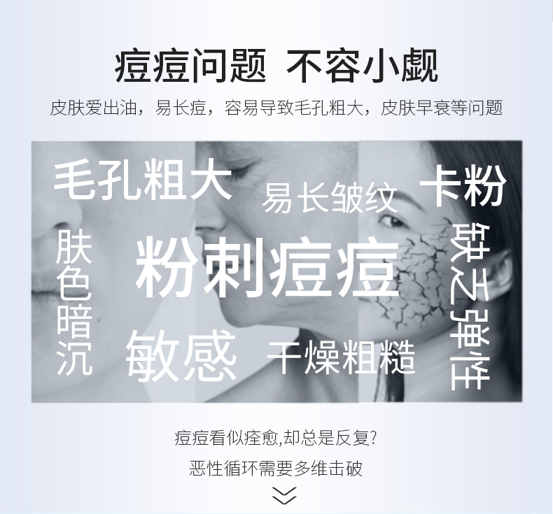 豆妃 祛痘爽肤水 80ml 有效祛痘/补水保湿/收缩毛孔 图2