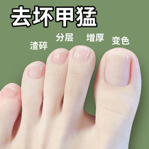 Tongrentang hot sale (refundable if damaged) Just a drop of it will turn bad nails into good ones grow new nails and enjoy a life of good nails