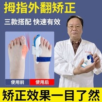 External reverse mother toe appliance correction toes correction toe correction appliance split toe improvement foot bone separation thumb valgus separator day