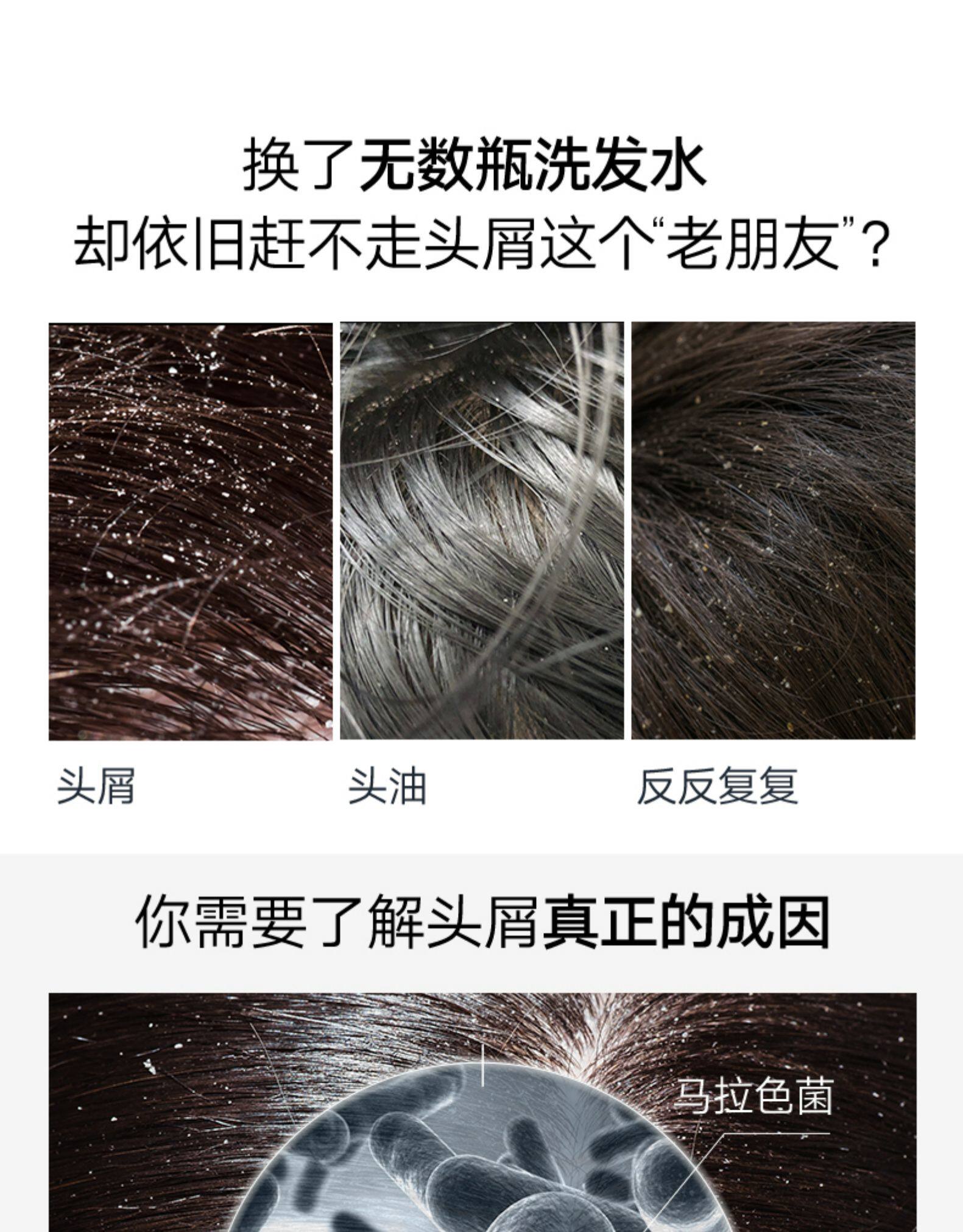 澳洲进口 selsun 洗发水无硅油 200ml 图4
