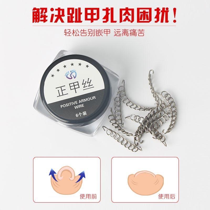 Nail Groove Corrector, Nail Correction Tape, Nail Straightening Wire, Toe Ingrown Toenail Correction Wire, Special Correction Wire for Nails Sticking into the Flesh