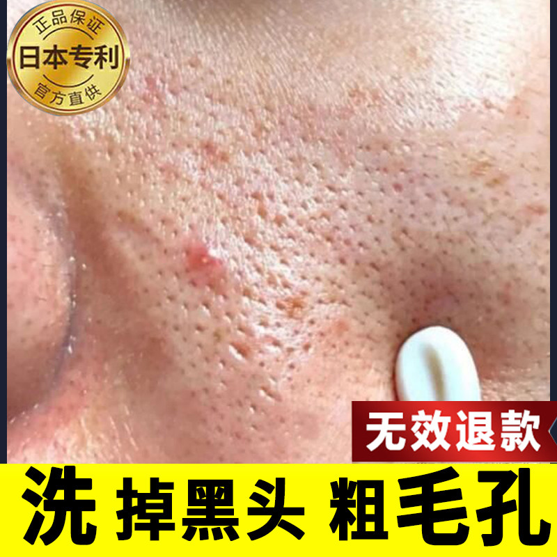 Amino acid facial cleanser shrinks pores, removes acne, controls oil, removes mites, removes blackheads, and deep cleans for men