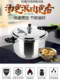 German thickened stainless steel pressure cooker induction cooker gas gas open flame universal pot household large capacity pressure cooker