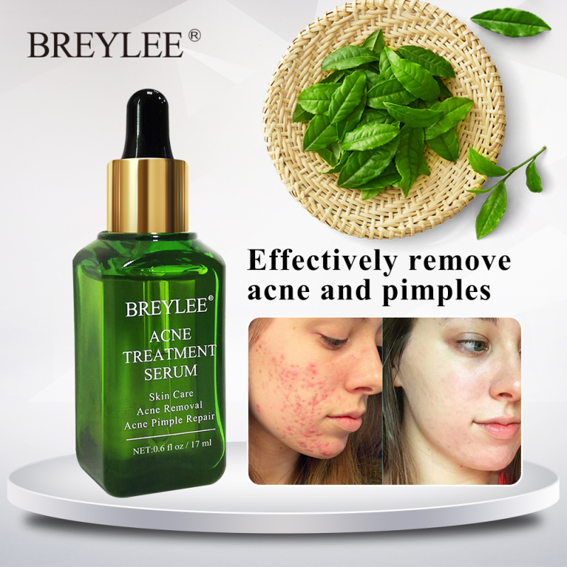 New Acne atment Face Serum Mask Anti Acne Pimple Scar Remove