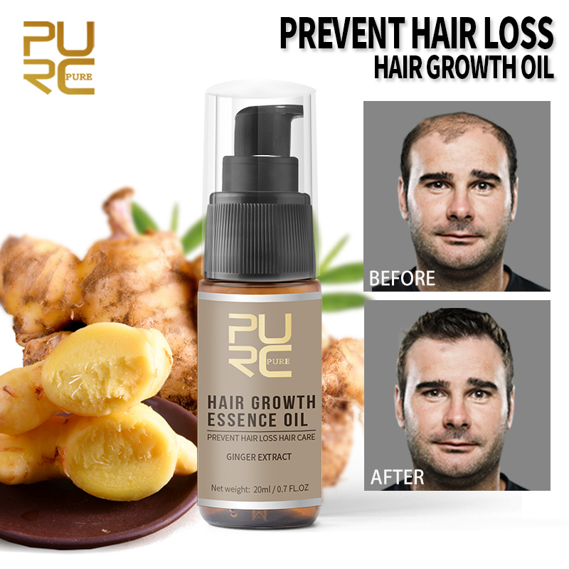 New 30ml 20ml Hair Growth Spray Anti Hair Loss Ginger Preven