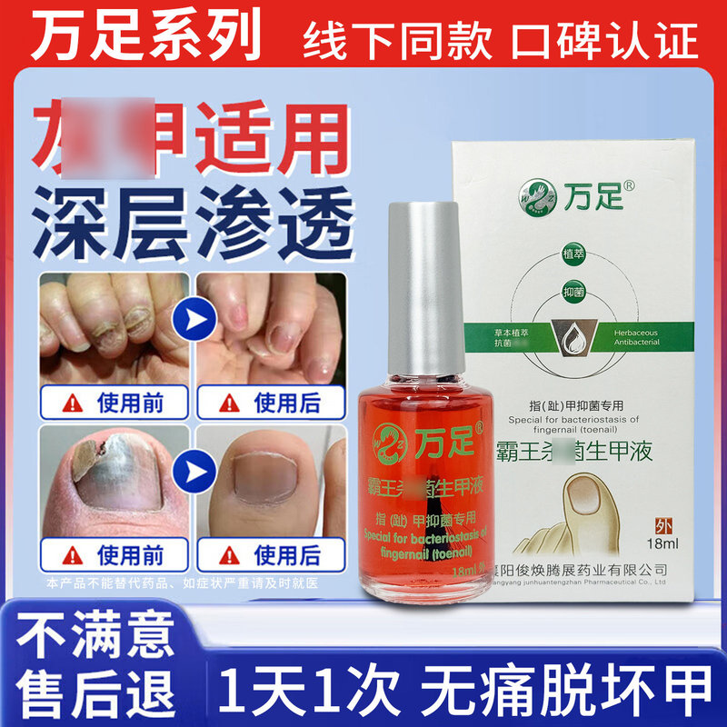 Wanzu Baowang Shasheng Nail Fungus Cream for Nail Care and Skin External Use, Same Product as Pedicure Shops, Not a Flagship Store