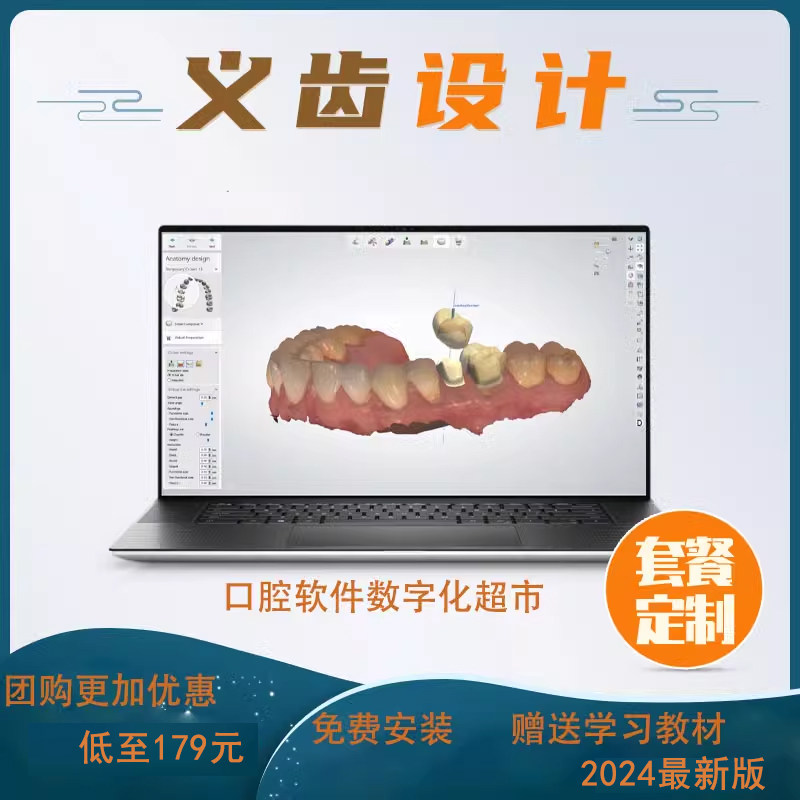 3shape exocad 2025 dental design software: 🦷 Digitalizing the oral ...