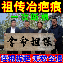 Scar Bumps Chest Thoracic front scar Hyperplasia Bumps remove repair Scar Cream Cover Theorist Double Eyelid Surgery Scar