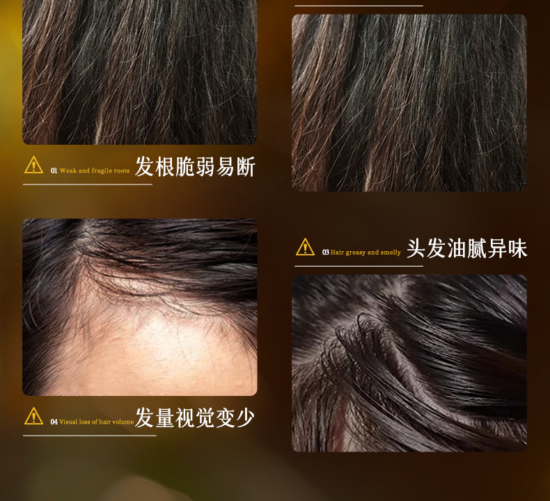 【中国直邮】 VHE 防脱洗发水 强韧健发洗发露控油蓬松男女防掉发洗头膏 400g