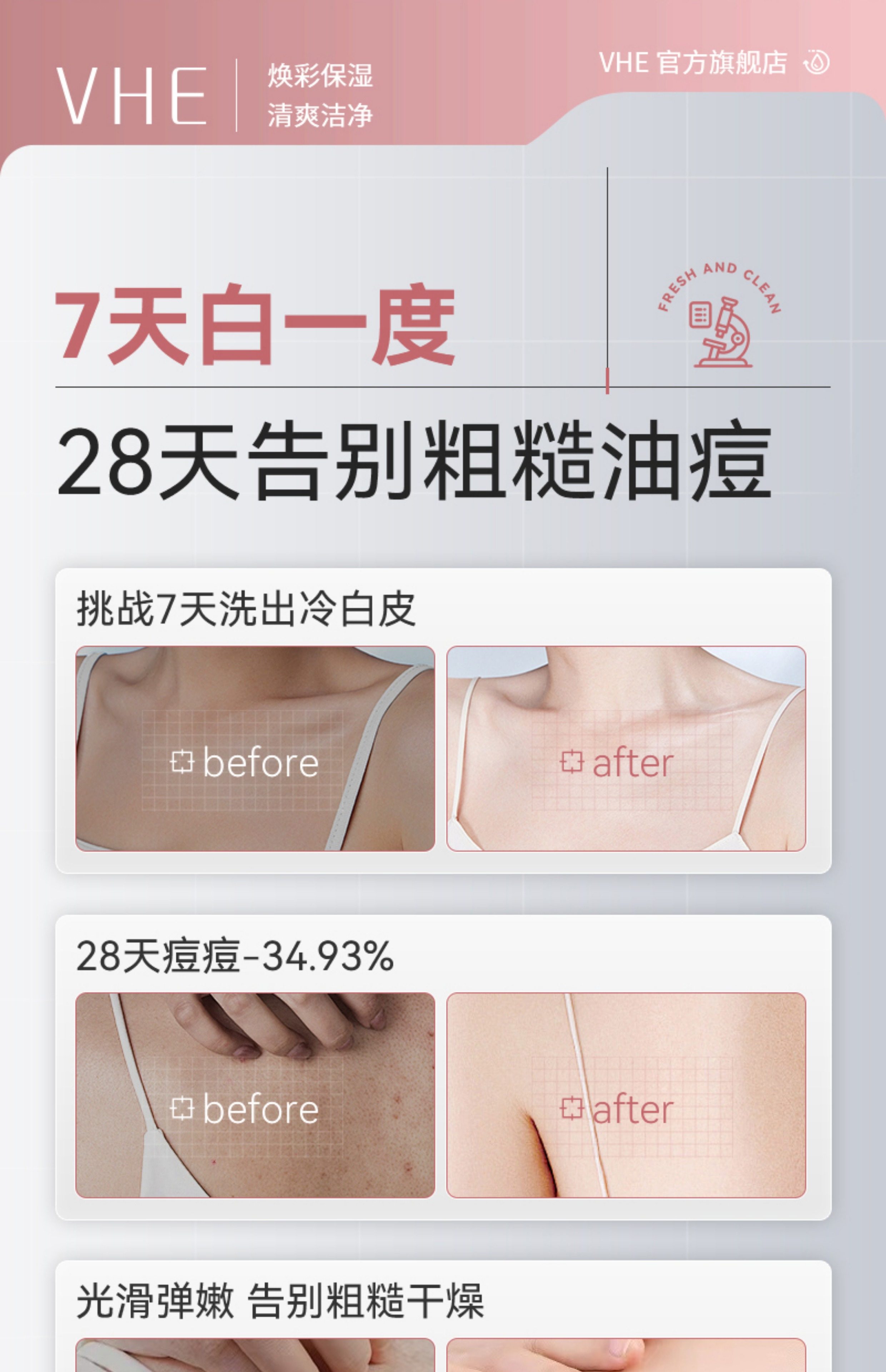 【中國直郵】 VHE 祛痘美白沐浴露 全身煥發保濕水潤持久留香乳液洗護男女 400g/瓶