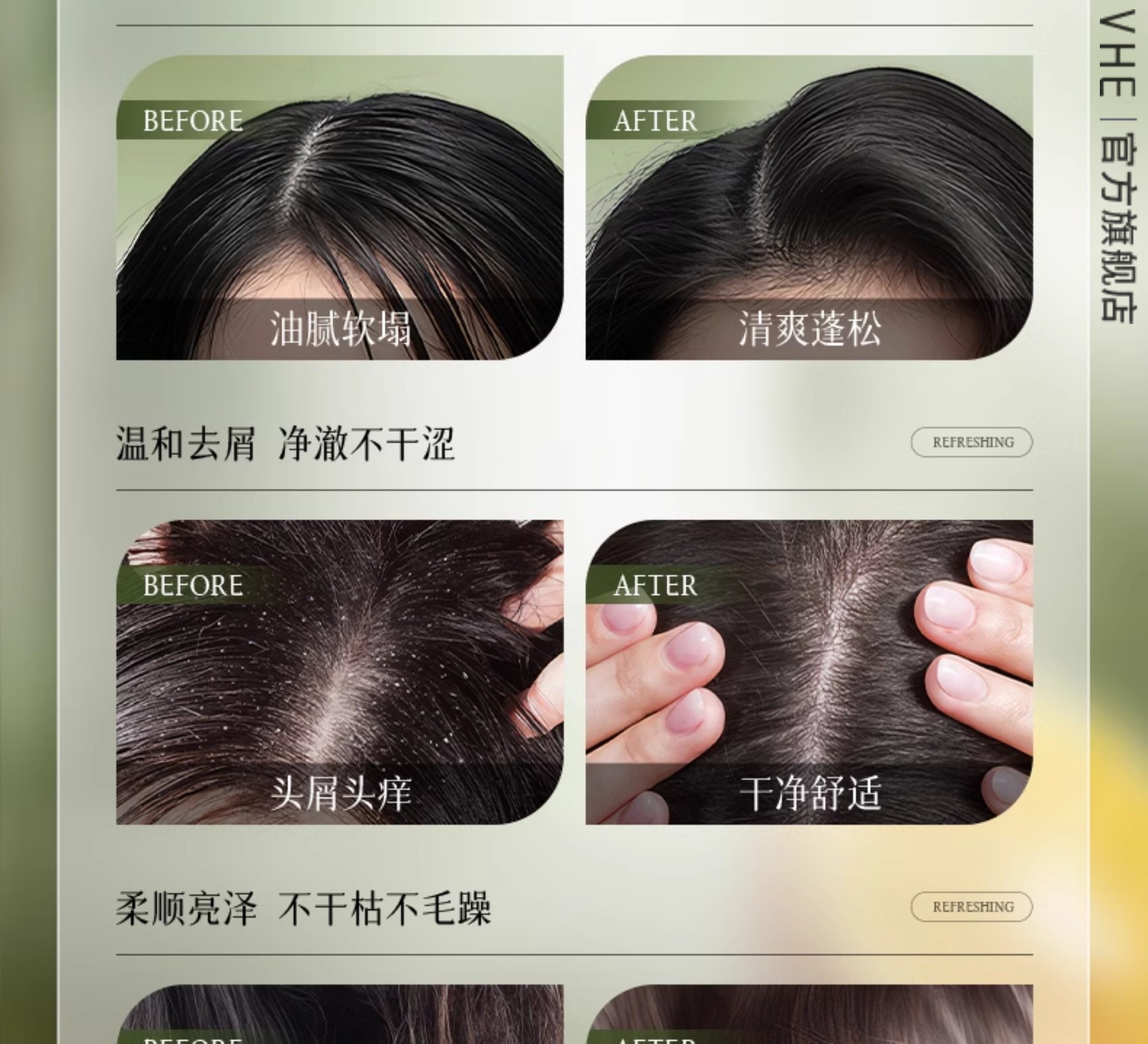 【中国直邮】 VHE 去屑洗发水 控油蓬松柔顺长时去油庠男女洗发露 400g/瓶