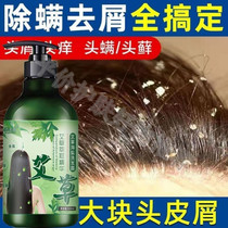 Childrens mugwort shampoo removes mites removes dandruff severely removes dandruff controls oil and relieves itching shampoo for men and women