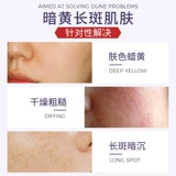 Импортная осветляющая увлажняющая маска для лица подходит для мужчин и женщин, удаление веснушек, осветляет кожу