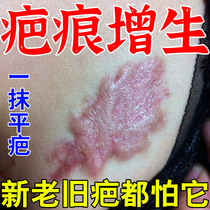 (A smooth scar) Scar hyperplasia pimples and bulges removal of bulges bumps and convexities softening of acne marks traceless falls burns