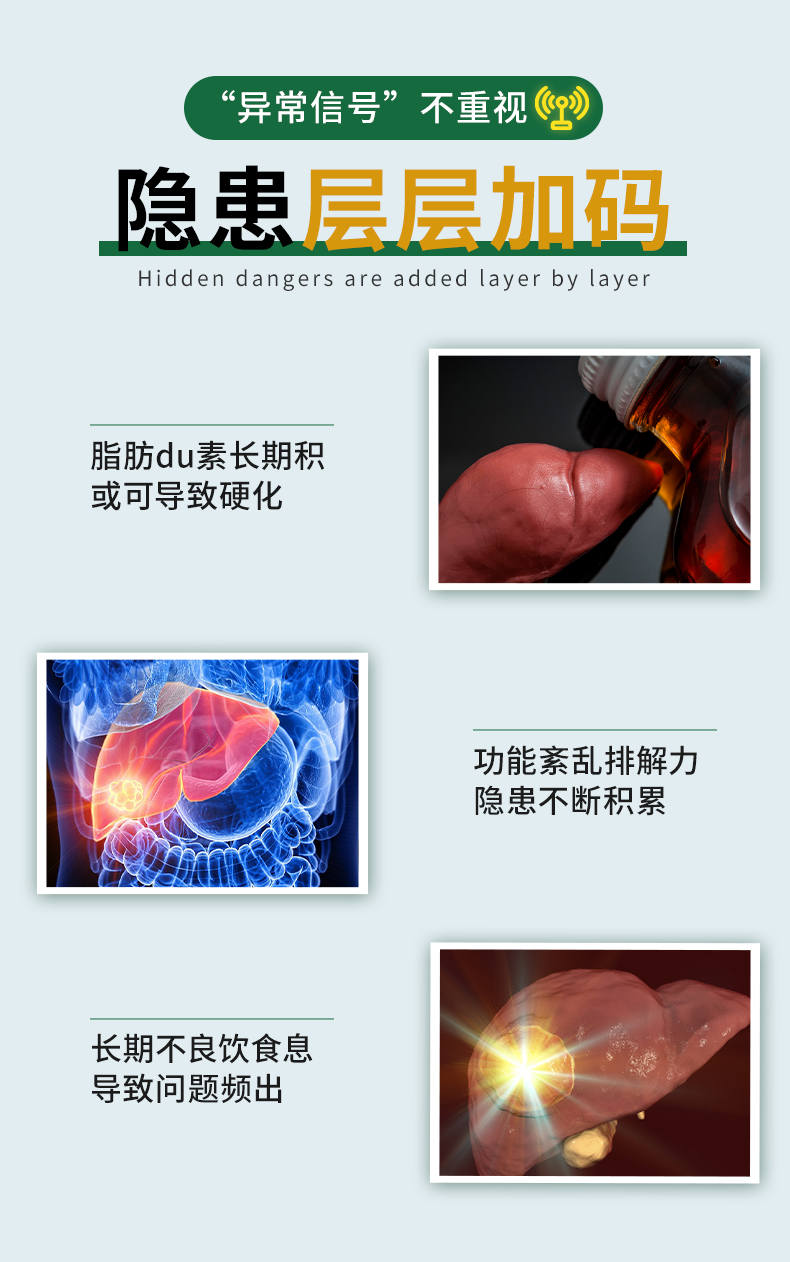 Sorlife 水飞蓟素奶蓟草软胶囊 60粒 排毒养肝 图3