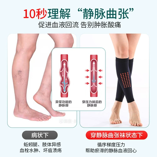 Леопардовые медицинские варикозные варикозные вены упругие чулки для защиты теленка и типа лечения Вторичное давление в стиле антитербоза Диламленные нижние конечности