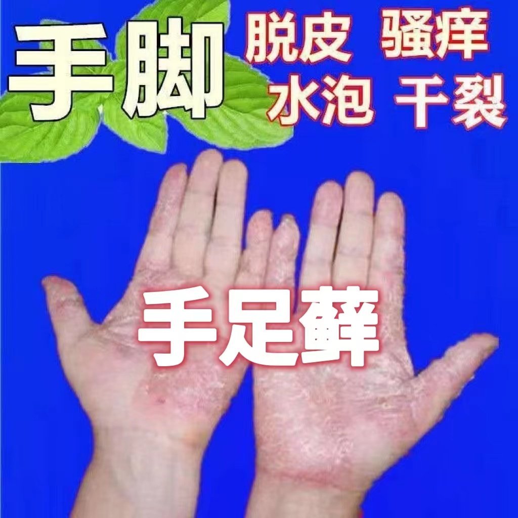 Cracked hands, heels, cracks, peeling, rough hands, back pain, itching, dry, cracked hands and feet