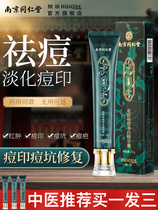 (Tongcheng anointed pit repair pasting pit for the male and female students to close the white