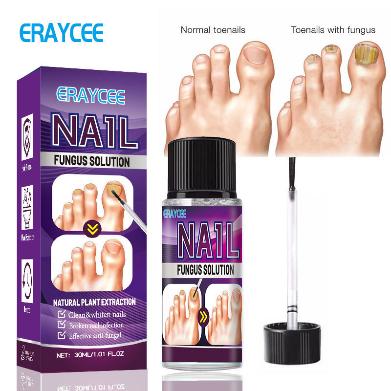 Eraycee Amazon Plant-Based Liquid for Thickening and Repairing Nails and Cuticles, Soft Nail Repair Liquid for Hands and Feet