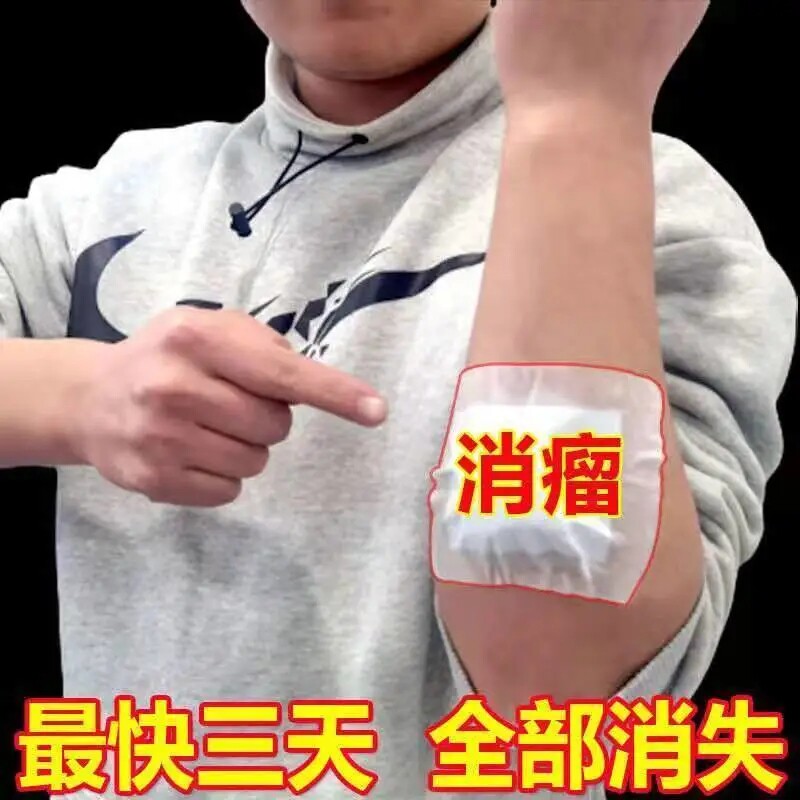 Lipoma removal artifact paste herbal special subcutaneous treatment to eliminate hard lumps multiple nemesis private