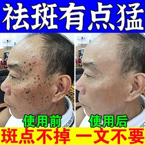 Freckle cream artifact whitening and lightening freckles freckles chloasma sunburn age spots cream