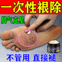 Japans beriberi remover artifact cures itchy feet peeling rotten feet blister type ointment fungal infection sterilization and antipruritic