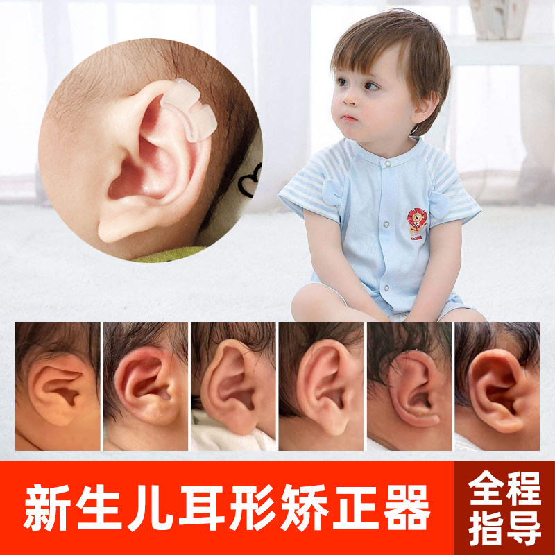 耳朵矫正器婴儿新生的儿耳廓矫形贴纠正塑形定型神器外耳耳夹宝宝