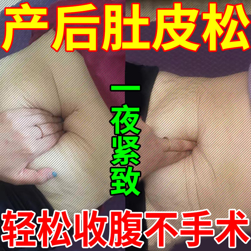 Abdominal straight muscle separation repair post-abdominal muscle Exercise conditioning Moonosis Abdominal Exercise Pelvic Floor Muscle Special in Ointment Paste