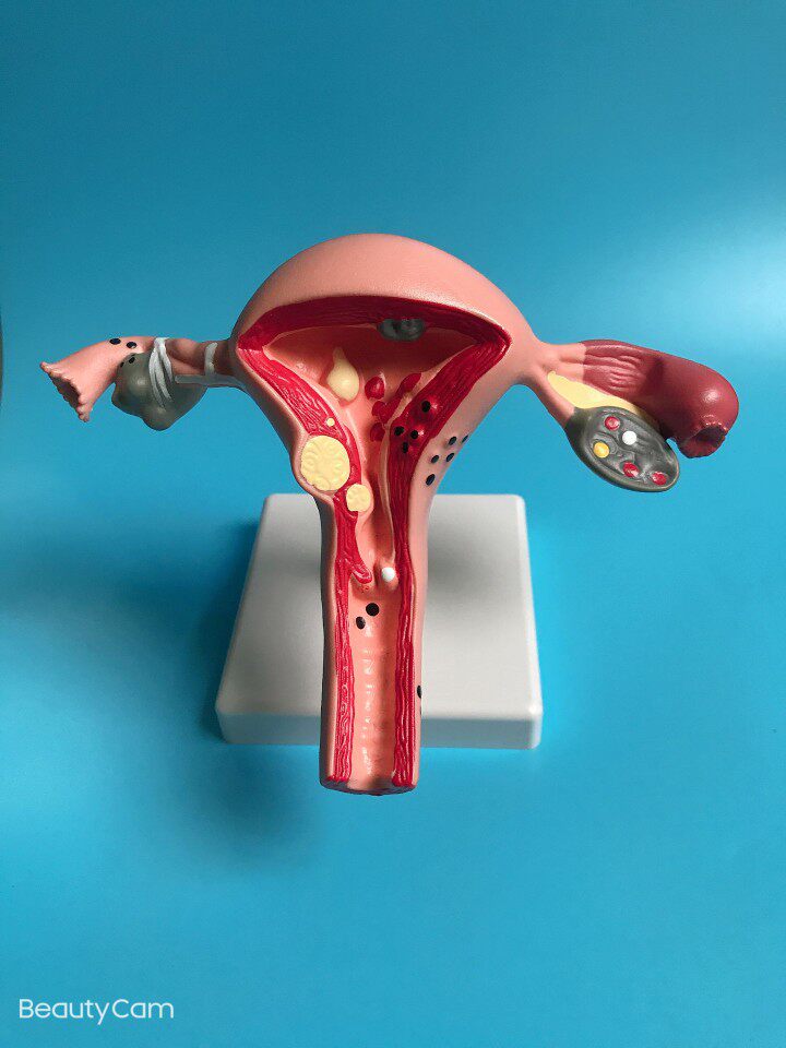 人体女性生殖子宫解剖病理展示模型 教学模型 妇科教具新款包邮