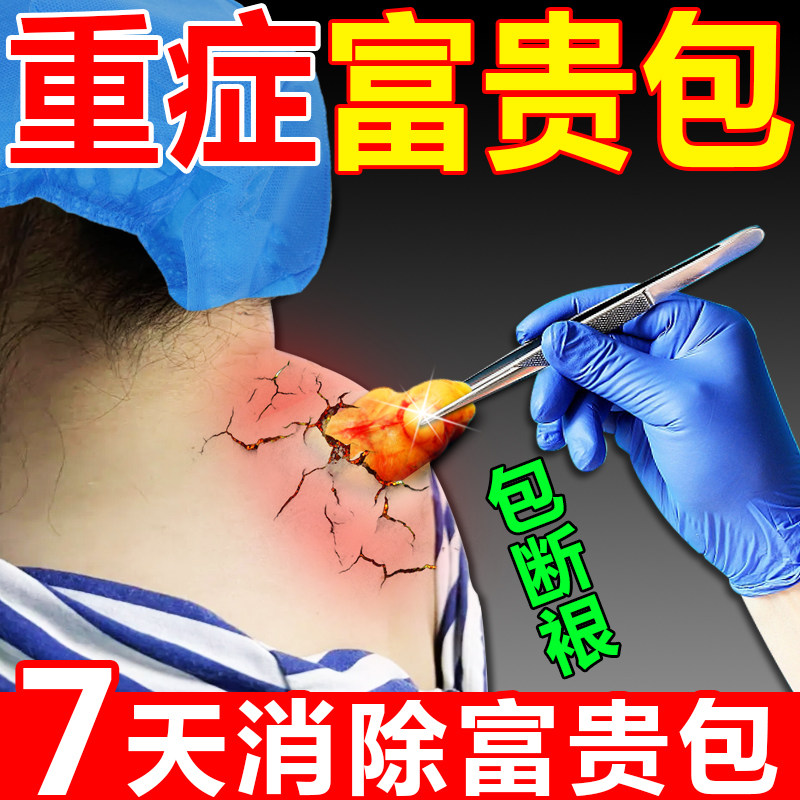 Serious wealth package cervical spine wealth package to eliminate artifact neck drum package to clear the neck and cervical spine pain and stiffness G