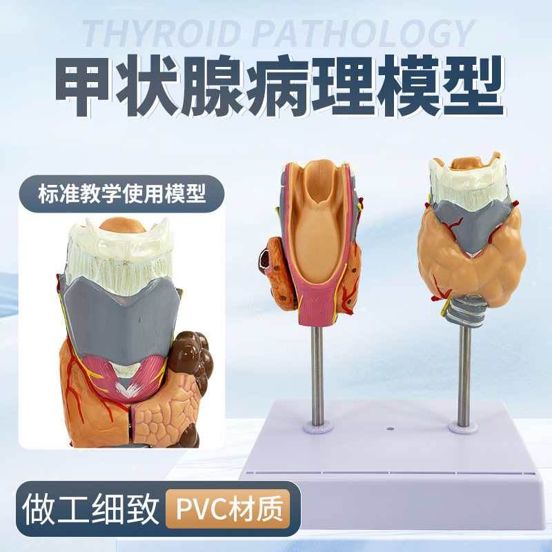 人体病理甲状腺模型甲亢甲低内分泌系统医学解剖甲状腺喉头教具