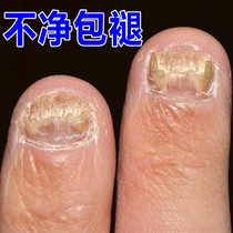 (Watsons best-selling) One drop of it can inhibit bacteria without removing nails and remove 99% of gray potassium fungi. If invalid return guarantee