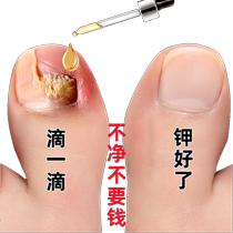 (Tongrentang Hot Sell) No pain for new potassium to enjoy a good A life Bad A to get a good jia drop a drop
