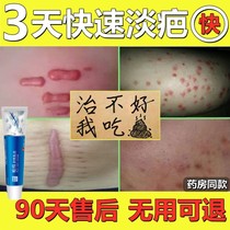 Scarring Hearty Repair Paste Hyperplasia Raised Goose Scar Surgery Scar Fades And Rugged Black Pigment Precipitates To Remove Pimple Print