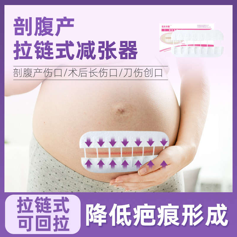 免缝针减张器佳夫卡瑞拉链式创口贴医疗用品防水伤口护理贴