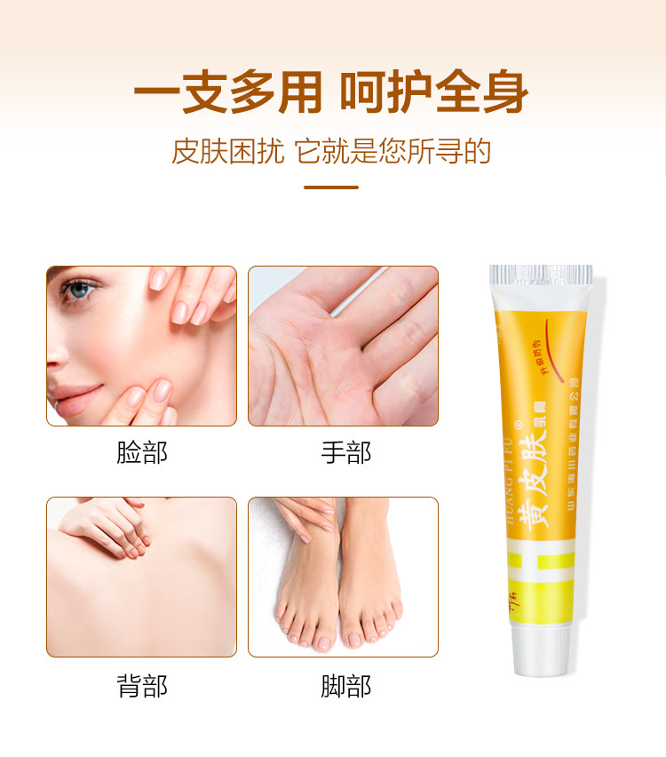 【中国直邮】黄皮肤抑菌乳膏 清凉止痒 消疹消红 15g*1支