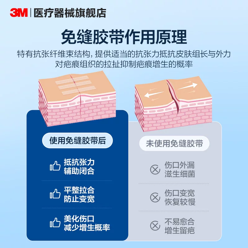 3M Редюс наклейки медицинские детские наклейки для ран без шва кожа послеродовой рубец ленты шрам stickers