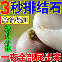 Chinese herbal appliquity of kidney stone fossils (one second pain relief) gold money grass fossilized discharge of tea calculus shaking theorizer