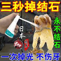 Going to dental calculus Special spray Quick Quick Dissolving Tooth Stone Fungicide Removal of dental plaque Tooth Stains Tooth Stains Yellow Tooth deity Dentistry Toothpaste