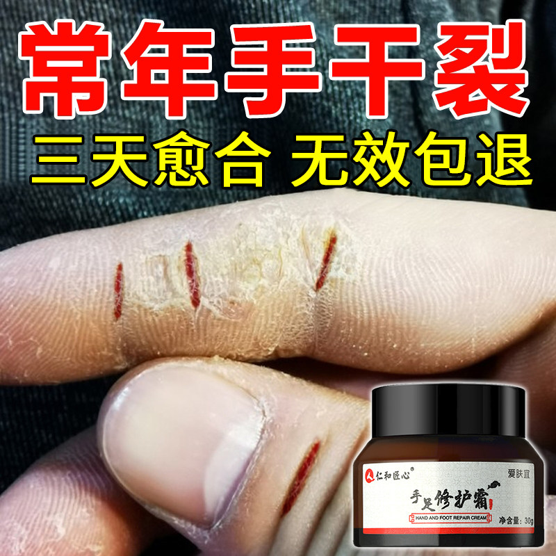 Hand and foot dry and cracked repair cream (effective in the evening), cracked and peeled heel, anti-cracking hand cream, chapped frostbite