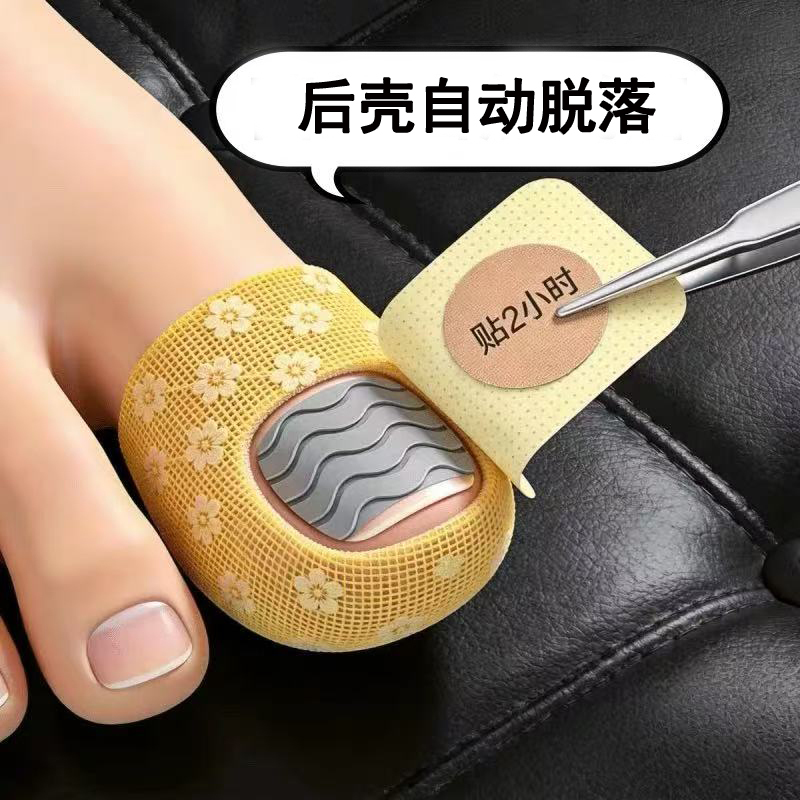 【Hot-Selling Chinese Medicine Product】Specialized Nail Removal Patches with Plant Extracts, Genuine Product, Suitable for Both Toes and Fingers 【Hot-Selling Chinese Medicine Product】Specialized Nail Removal Patches with Plant Extracts, Genuine Product, Suitable for Both Toes and Fingers