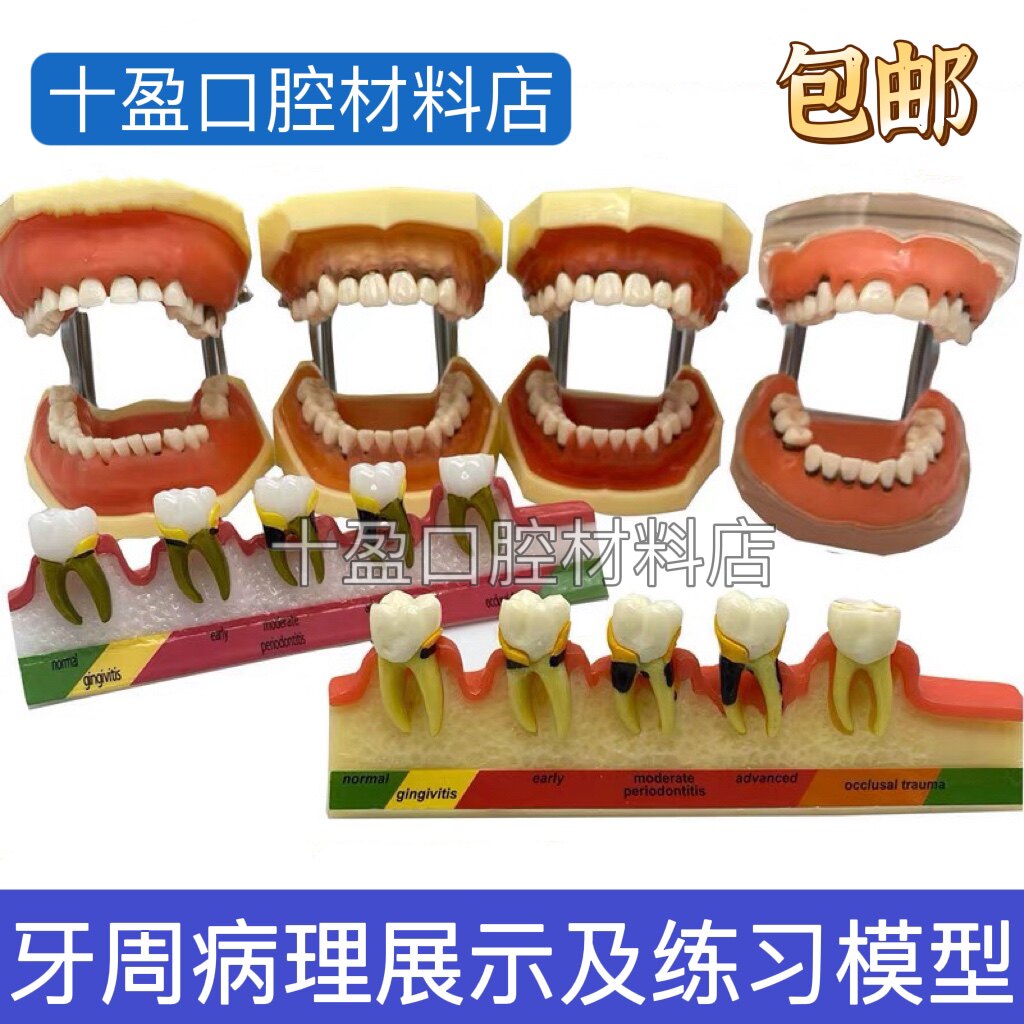 牙科口腔教学模型 牙周病理模型 练习刮治结石 牙周分类发展进程
