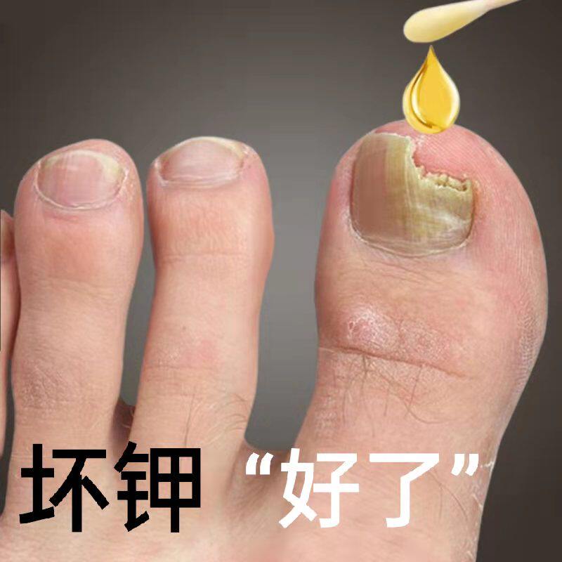 New (Tongrentang Recommended) Drop a drop of bad potassium net gray potassium to a good potassium-one drop of new A bad potassium gram