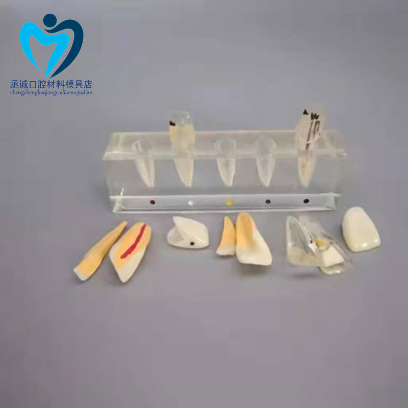 牙科口腔教学 牙髓修复模型 牙齿解剖模型 可分解医患沟通模型