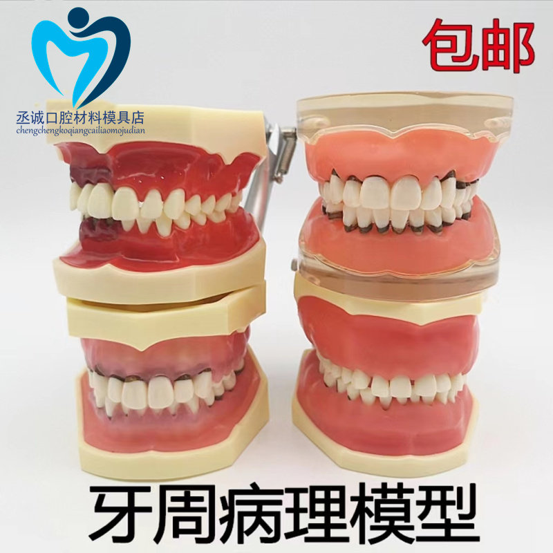 牙科口腔模型牙周病理修复模型 牙周牙龈刮治模型 牙结石牙周模型