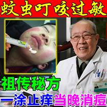 Mosquito bites anti-itch and swelling ointment to cure infant adult flea mosquito bites allergy redness pruritus special