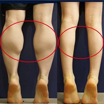 (Little Red Book Recommended) Body leaving no trace of the summer wearing a short dress no longer awkward to buy three delivery two