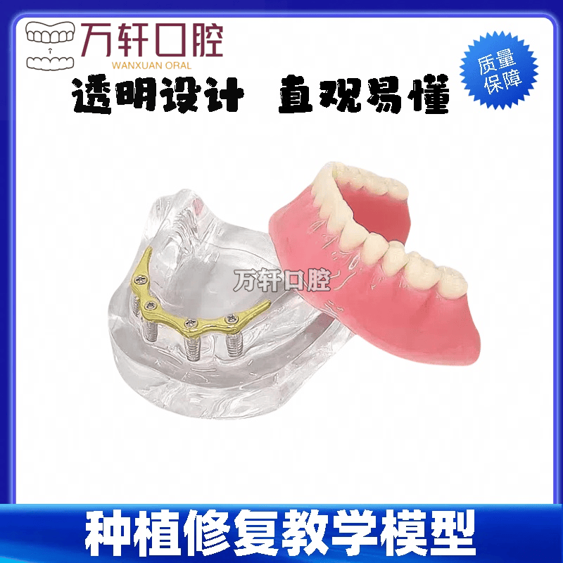 牙科口腔教学 齿科修复模型 金杆卡 银杆卡 种植体解说  医患沟通